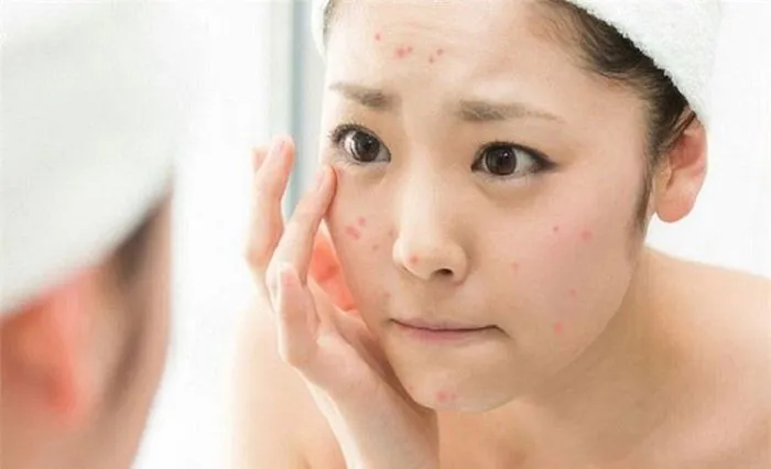 aio_gallery_image_aio-widget-aio_gallery_image-1510001-template